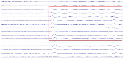 640?wx_fmt=png&tp=webp&wxfrom=5&wx_lazy=1&wx_co=1.jpg
